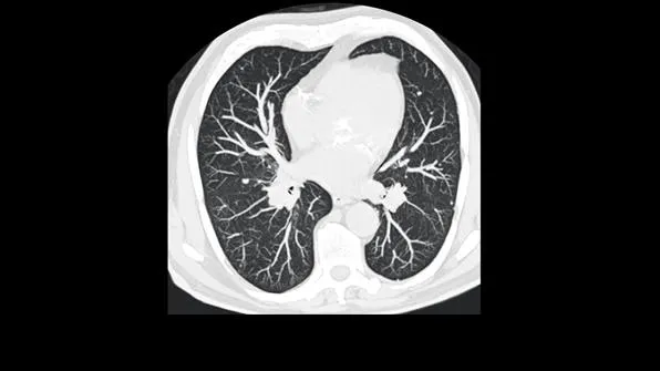 Клинические изображения Siemens SOMATOM go.Now компьютерный томограф