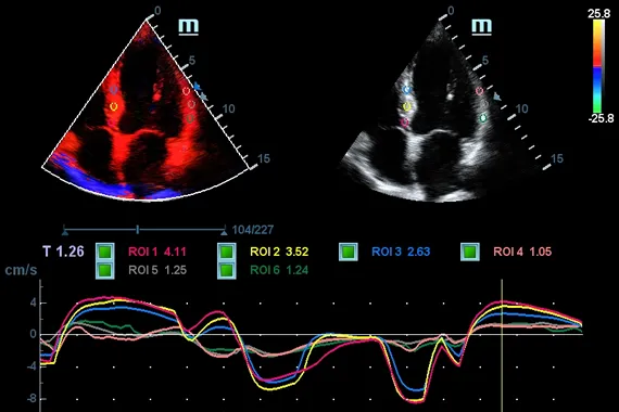 Клинические изображения УЗИ аппарат Mindray DC-45