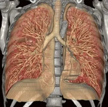 Клинические изображения Canon ASTELION 16 (32) Компьютерный томограф
