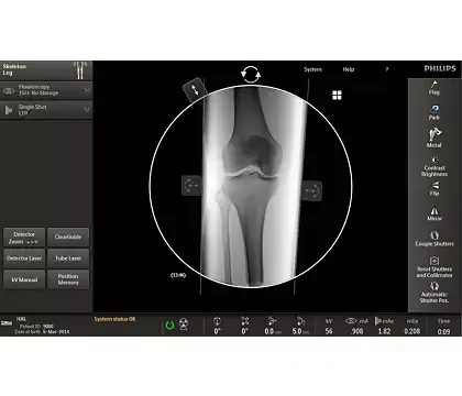 Клинические изображения Philips Veradius Unity С-дуга
