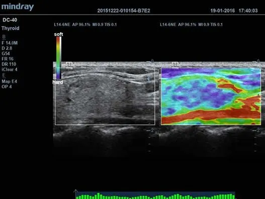 Клинические изображения УЗИ аппарат Mindray DC-40