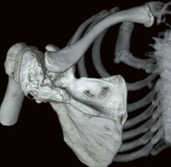 Клинические изображения Canon ASTELION 16 (32) Компьютерный томограф