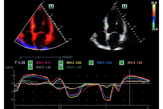 Клинические изображения УЗИ аппарат Mindray DC-45