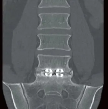Клинические изображения Canon ASTELION 16 (32) Компьютерный томограф