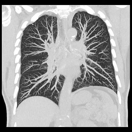 Клинические изображения Компьютерный томограф Canon Aquilion Prime SP