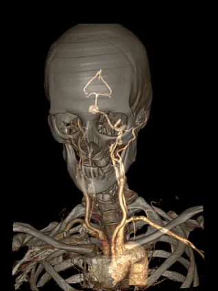 Клинические изображения Компьютерный томограф GE Optima CT540