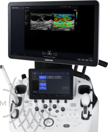 Samsung Medison HS60 УЗИ аппарат