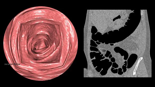 Клинические изображения Siemens SOMATOM go.Up компьютерный томограф