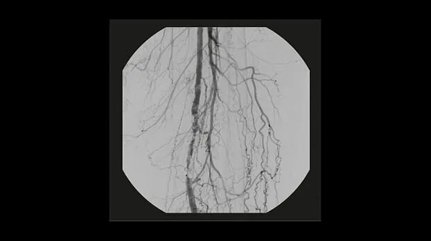 Клинические изображения Рентгенохирургический аппарат типа С-дуга GE OEC Elite CFD