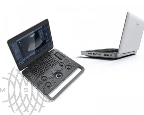 Sonoscape X3 ультразвуковой аппарат