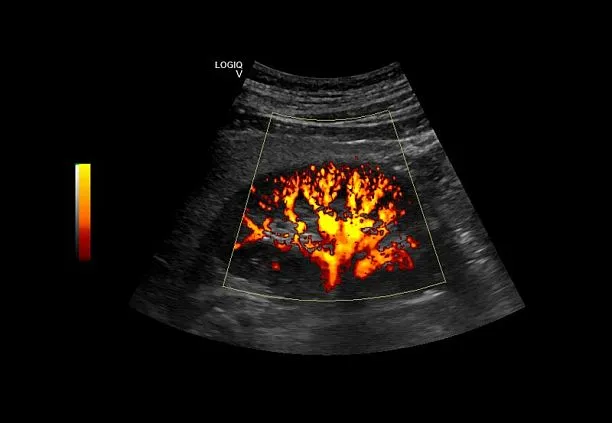 Клинические изображения Ультразвуковая диагностическая система GE Logiq V2 УЗИ портативная