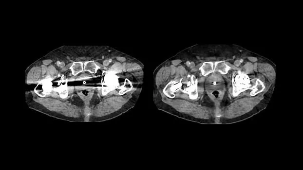 Клинические изображения Компьютерный томограф GE Revolution Maxima