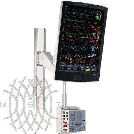 Монитор пациента Mindray V21
