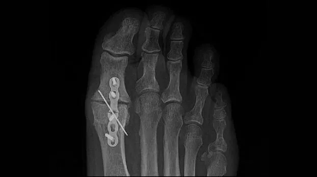 Клинические изображения GE HealthCare Optima XR240amx палатный цифровой рентгеновский аппарат