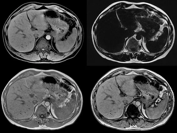 Клинические изображения Магнитно-резонансный томограф GE HealthCare Optima MR450w