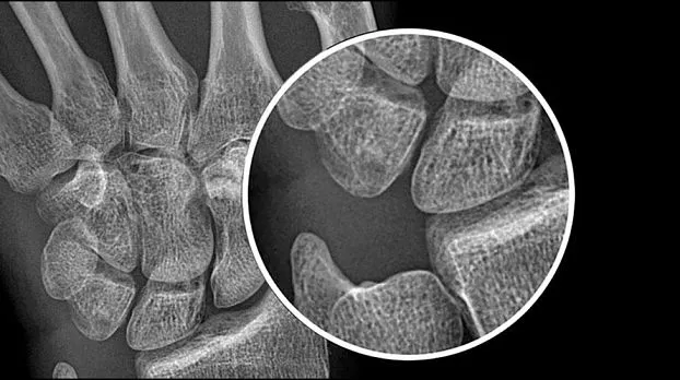 Клинические изображения GE HealthCare Optima XR240amx палатный цифровой рентгеновский аппарат