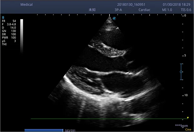 Клинические изображения Ультразвуковой аппарат Sonoscape S2N