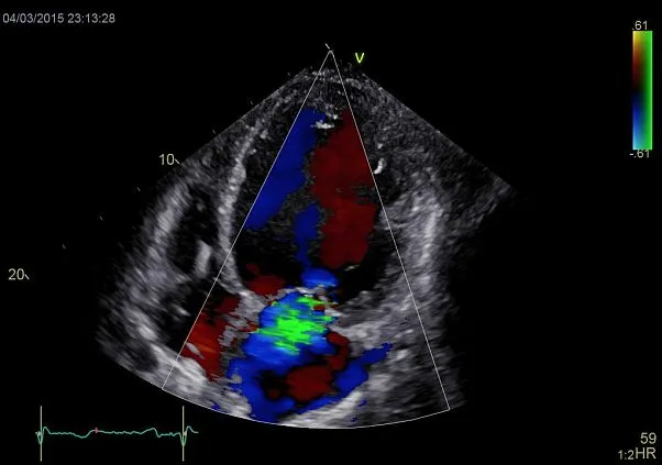 Клинические изображения УЗИ аппарат GE HealthCare Vivid E90
