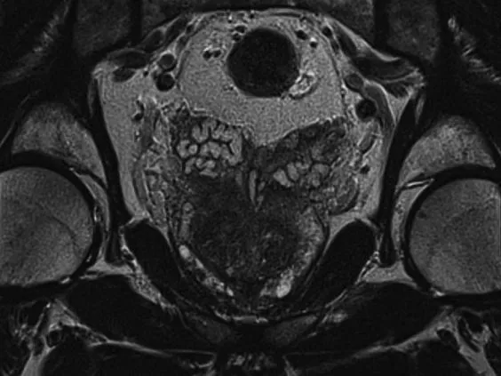 Клинические изображения Магнитно-резонансный томограф Siemens MAGNETOM Aera 1.5T