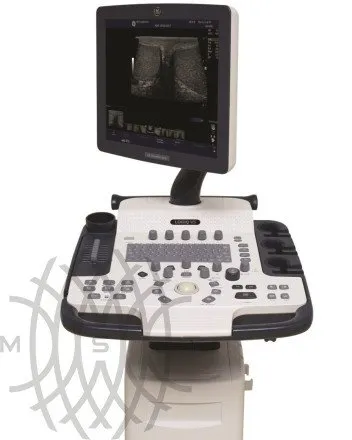 Ультразвуковая диагностическая система GE Logiq V5
