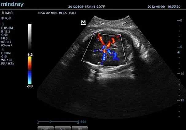Клинические изображения УЗИ аппарат Mindray DC-N3