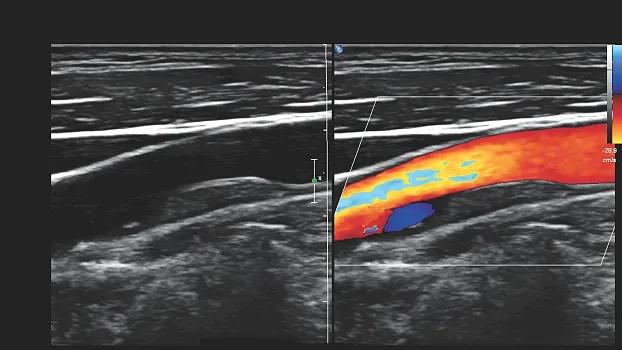 Клинические изображения Philips 5500 ультразвуковой аппарат портативный