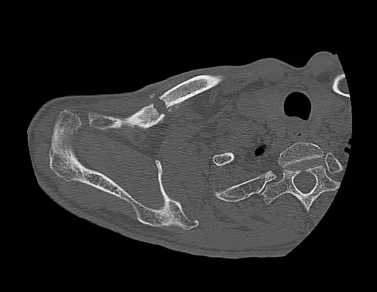 Клинические изображения Компьютерный томограф GE Optima CT540