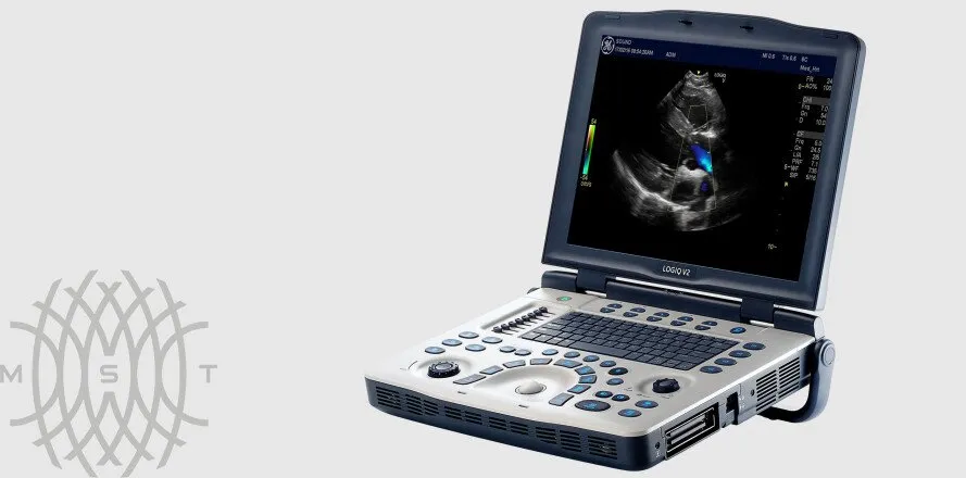 Ультразвуковая диагностическая система GE Logiq V2 УЗИ портативная