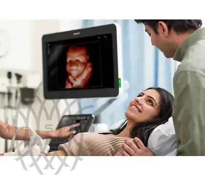 Philips EPIQ Elite ультразвуковой аппарат