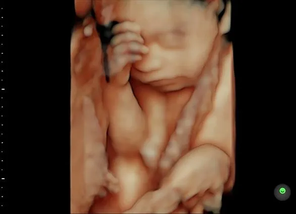 Клинические изображения GE Voluson S8 ультразвуковой аппарат