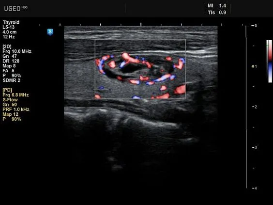 Клинические изображения Samsung Medison UGEO H60 УЗИ аппарат