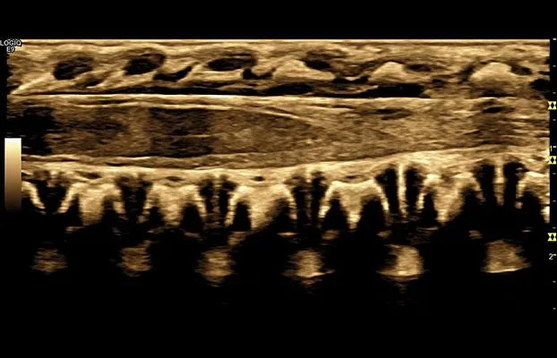 Клинические изображения УЗИ аппарат GE Healthcare Logiq E9 XDclear