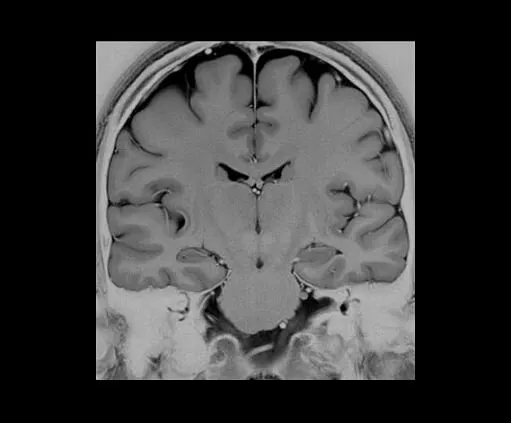 Клинические изображения МРТ аппарат GE SIGNA Architect 3T