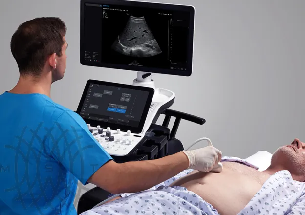 Samsung Medison V6 УЗИ аппарат