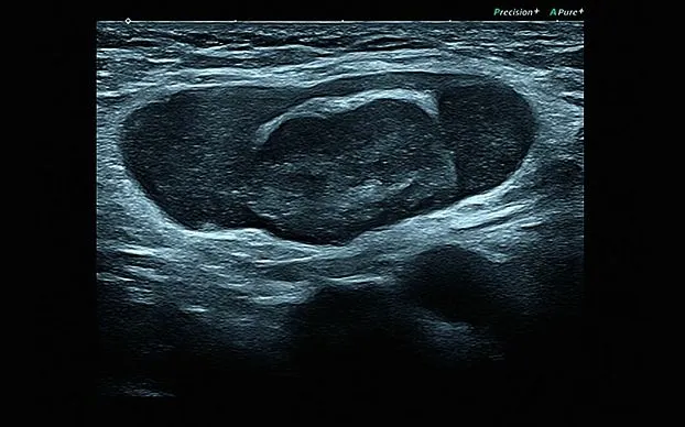 Клинические изображения Canon (Toshiba) Aplio i800 аппарат УЗИ