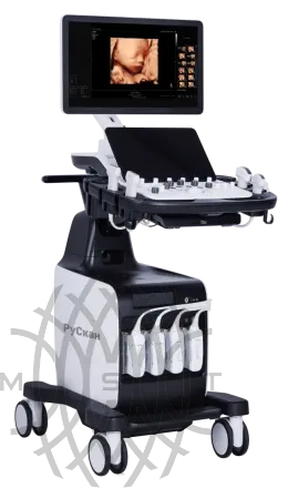 УЗИ аппарат РуСкан 80