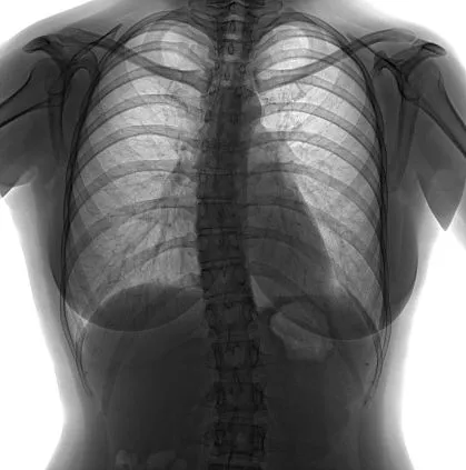 Клинические изображения Флюорограф цифровой С.П.Гелпик РЕНЕКС Ф-5000