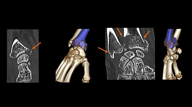 Клинические изображения GE Optima CT520 компьютерный томограф