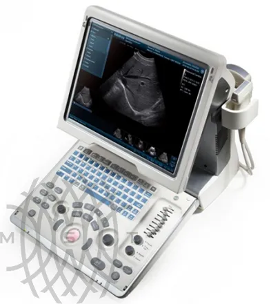 УЗИ аппарат Mindray DP-50 портативный