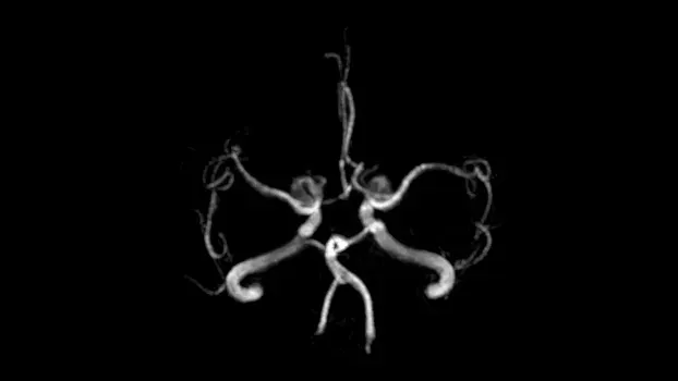 Клинические изображения Магнитно-резонансный томограф Siemens MAGNETOM Free.Max