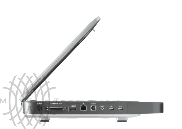 Sonoscape X5 ультразвуковой аппарат