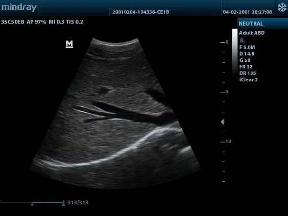 Клинические изображения УЗИ аппарат Mindray DP-20 Vet ветеринарный портативный