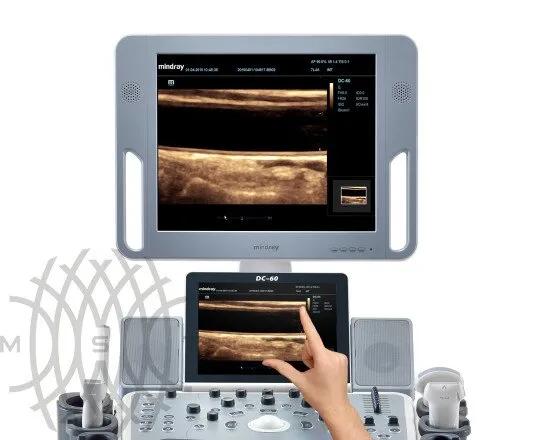 УЗИ аппарат Mindray DC-60 X-Insight