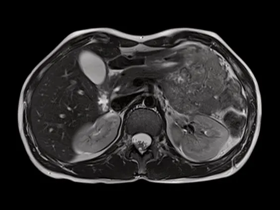 Клинические изображения Магнитно-резонансный томограф Siemens MAGNETOM Skyra 3T