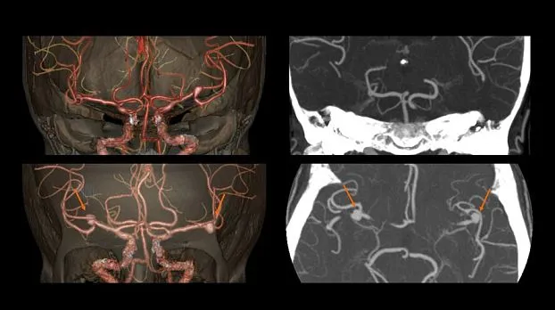 Клинические изображения GE Optima CT520 компьютерный томограф