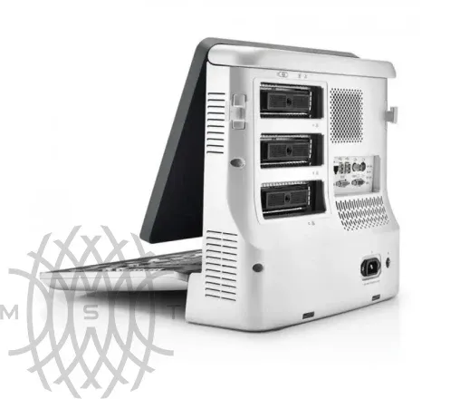 УЗИ аппарат Mindray Z60 Exp портативный
