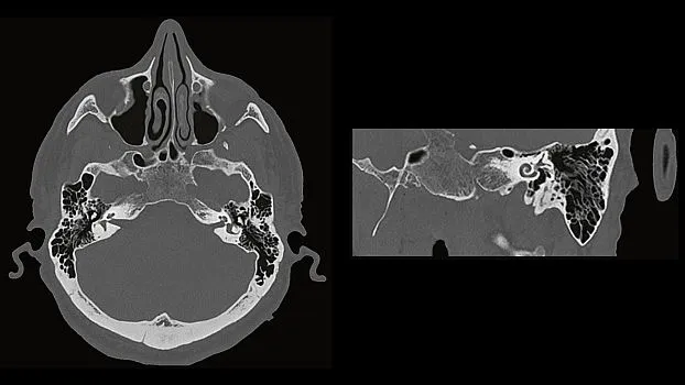Клинические изображения Siemens SOMATOM go.Up компьютерный томограф