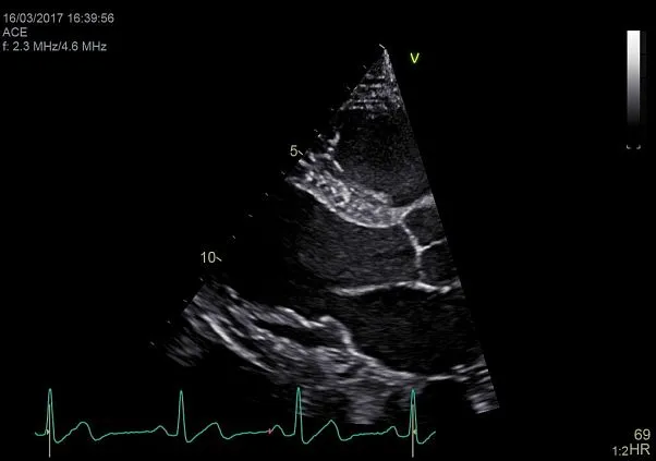 Клинические изображения Ультразвуковая диагностическая система GE HealthCare Vivid E95