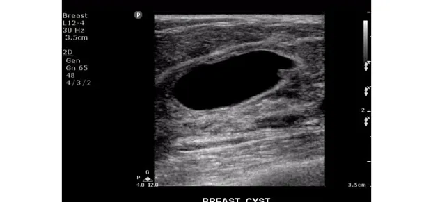 Клинические изображения Philips ClearVue 650 ультразвуковой аппарат