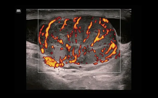 Клинические изображения УЗИ аппарат Mindray Resona i9